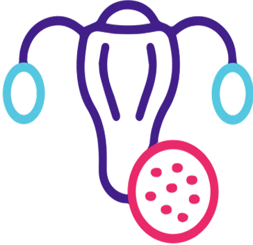 Uterine Fibroid Embolization icon